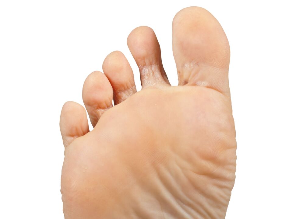 Furer-good-and-bair-and-hectic-cream-demyxil