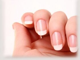 Healthy nails