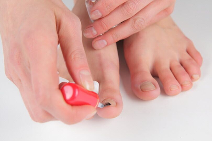 Prevent foot fungus