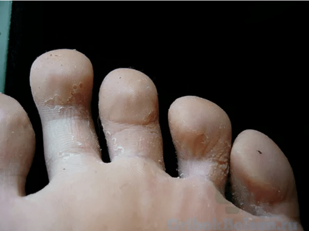 The stages of mushrooms